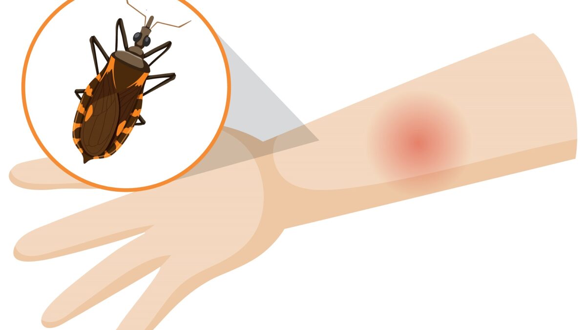 imagem de um braço picado por um mosquito