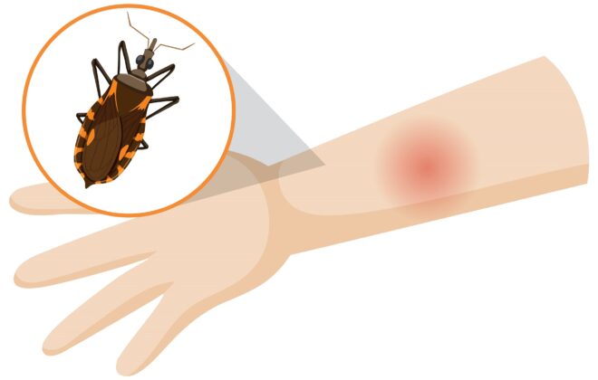 imagem de um braço picado por um mosquito